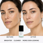 Dark Spot Correcting Serum thumbnail 5