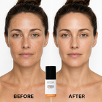 Vitamin C Wonders Oil Serum 15% thumbnail 5